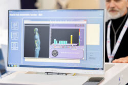 A screen displaying a virtual image of a human body, with several bar charts next to it