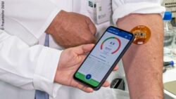 A person wearing a round sensor patch on their arm while another person holds a smartphone; Copyright: Fraunhofer IMM