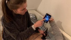 Image: young woman makes an ultrasound with the new system and shows patient the image on her smartphone; Copyright: Universitätsklinikum Bonn