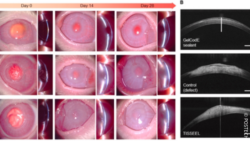 Image: Close-up of the healing process of a corneal ulcer, postoperative results in vivo; Copyright: POSTECH