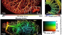 Image: photoacoustic images of microvessels of mice; Copyright: Chulhong Kim (POSTECH)