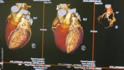 Image: Colored, three-dimensional images of the heart on a monitor; Copyright: Messe Düsseldorf
