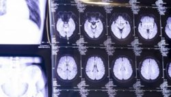 Image: a brain CT scan at MEDICA trade fair; Copyright: Messe Düsseldorf